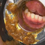 Piledriver Mouth Defecation 01
